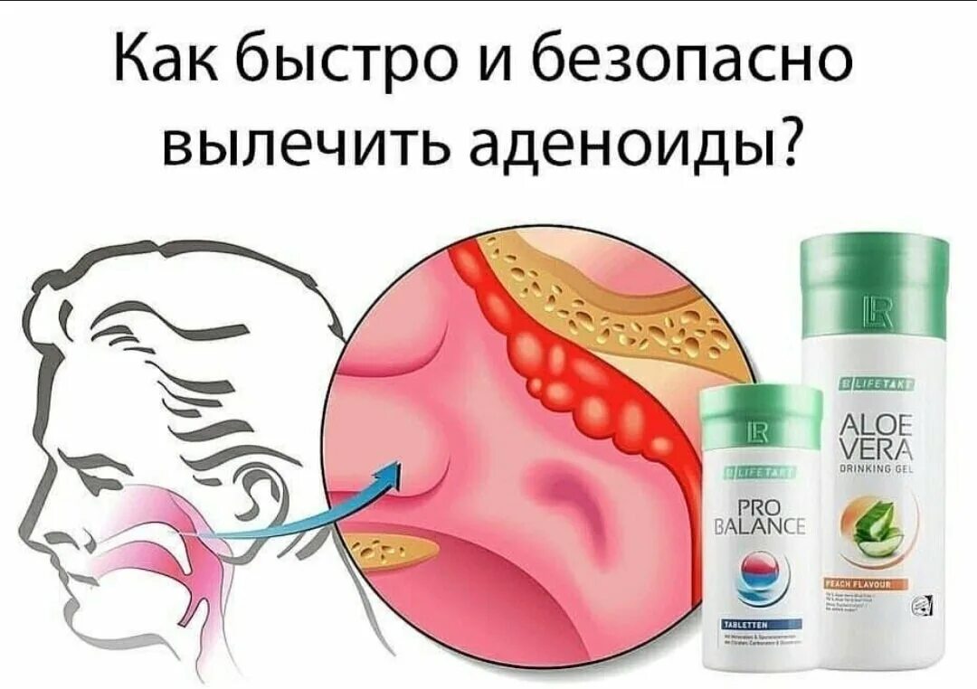 Аденоиды ребенок часто болеет. Красное горло у ребенка фото. Врач осматривает пациента на дому в маске. Симптомы аденоидов у детей. Болит голова после удаления аденоидов у детей.