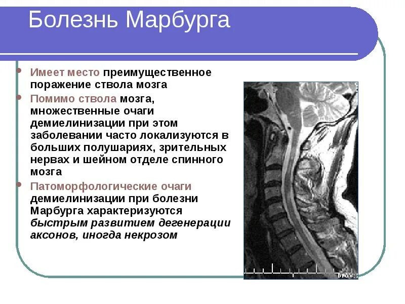 Марбуг