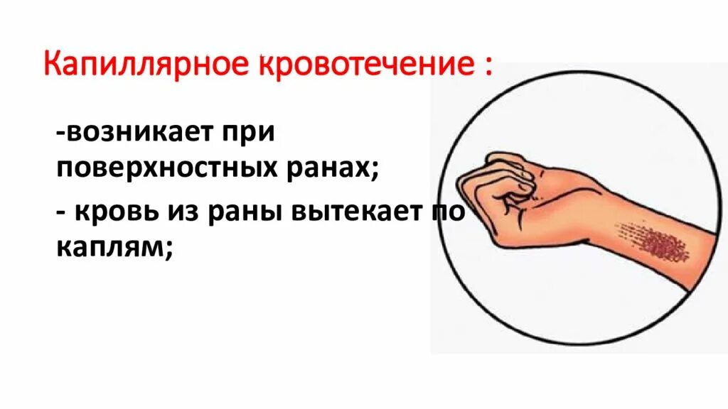 Первая помощь при простой и неглубокой ране