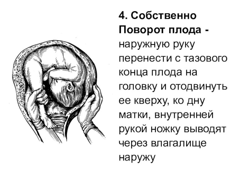 Положение плода в животе. Поперечное положение плода. Неправильное положение плода. Поперечное и косое положение плода. Поперечное положение плода УЗИ.