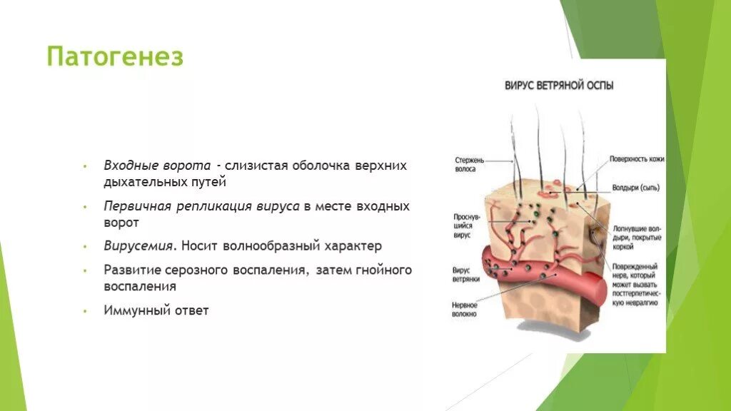 Входные ворота ветряной оспы. Патогенез ветряной оспы. Вирус ветряной оспы патогенез.