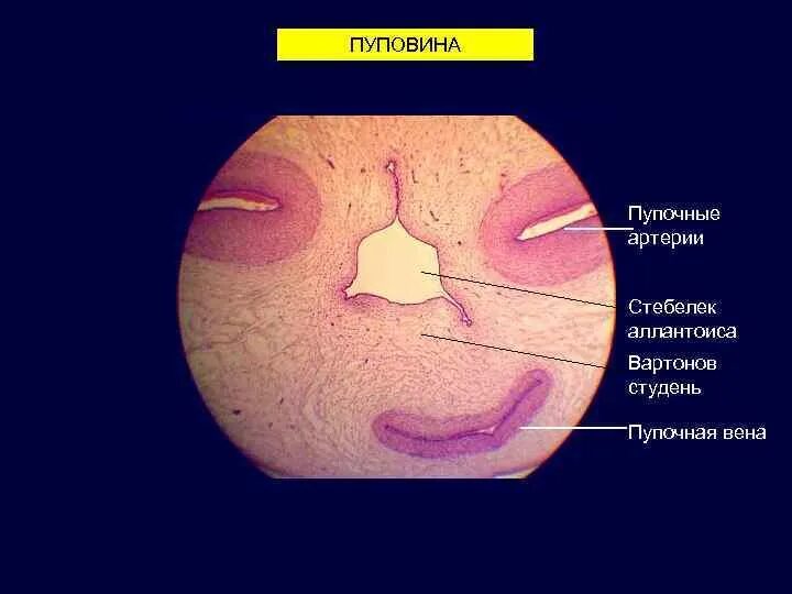 Строение пуповины гистология. Пупочная Вена гистология препарат. Строение пупочного канатика гистология. Пупочный канатик гистология препарат.