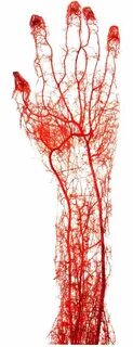 Devils veins