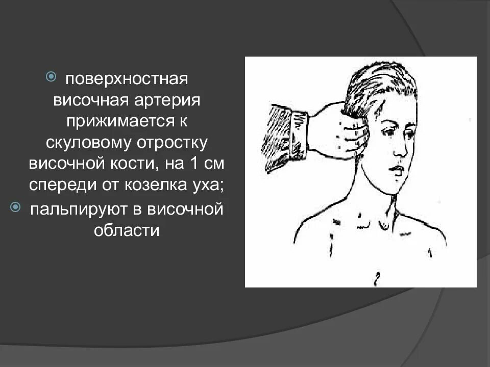Кровотечение височной артерии. Прижатие височной артерии. височная артерия прижимается. прижатие поверхностной височной артерии. височное пальцевое прижатие.
