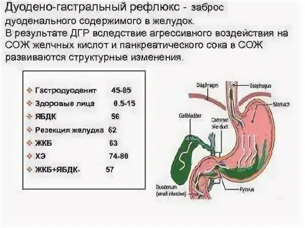 Дуодено гастральный рефлюкс что это