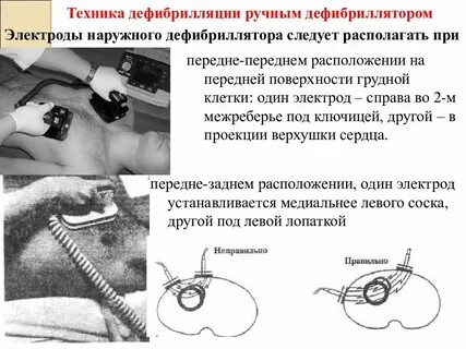 Ручного применения автоматического применения