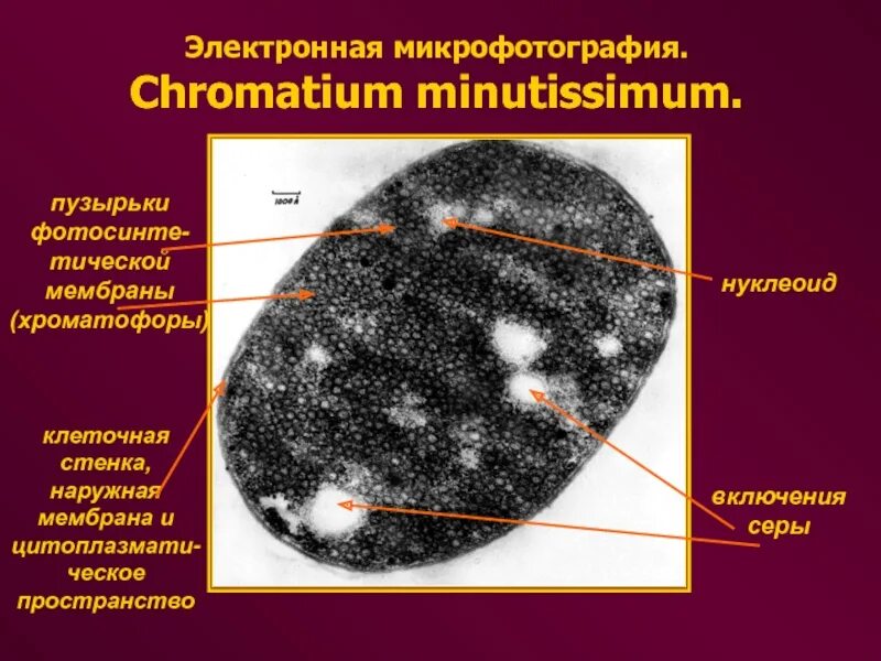 ядро электронная микрофотография. т лимфоциты электронная микроскопия. электронограмма гранулы гликогена. описание микрофотографий. описание микрофотографий.