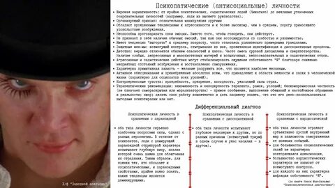 Антисоциальная личность
