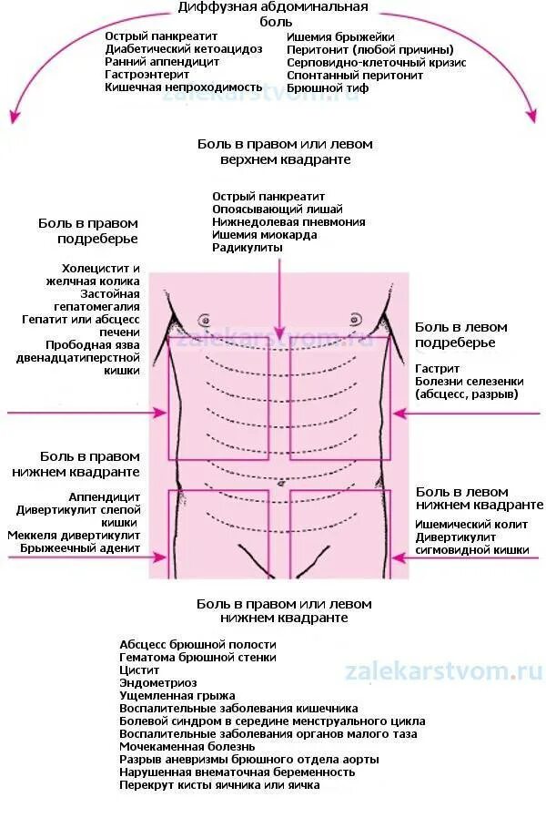 Почему болит слева. Почему болит левая сторона живота снизу. болит внизу сбоку слева от живота. болит под правым ребром сбоку спереди. болит с левой стороны сбоку живота.