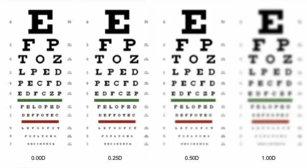 2 25 какое зрение. Зрение -15. Зрение 60%. Зрение минус 15. Visual Acuity 20/60.