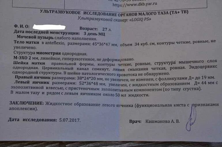 Результат гистологии эндометрия