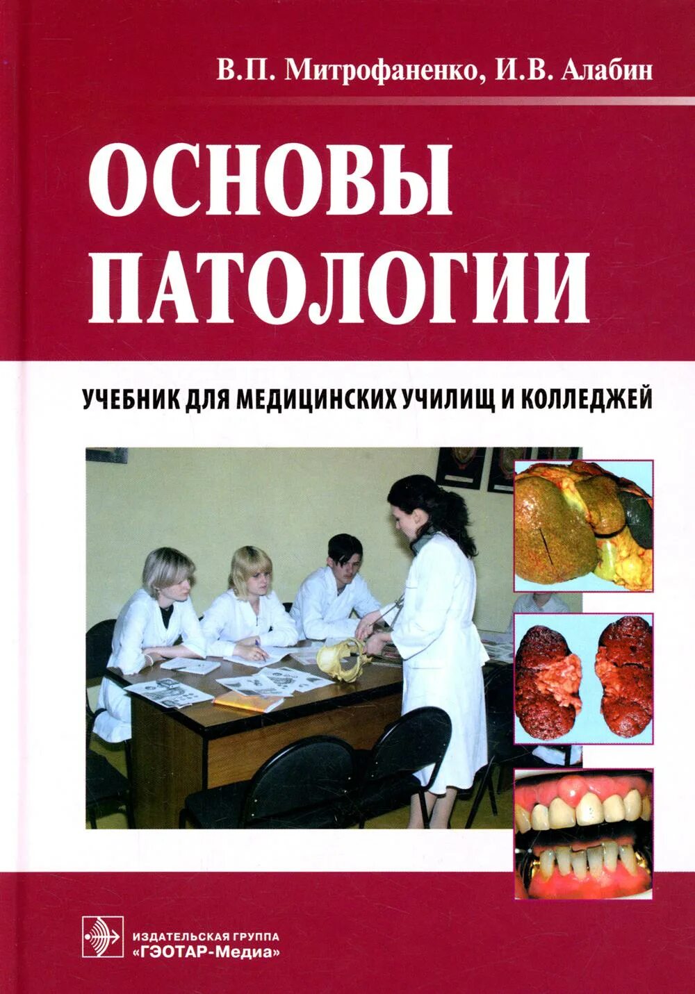 Книга основной основ. Учебник по основам патологии для медицинских колледжей Митрофаненко. ГЭОТАР Медиа учебник по патологии. Митрофаненко, в. п. основы патологии : учебник. Основы патологии книга.