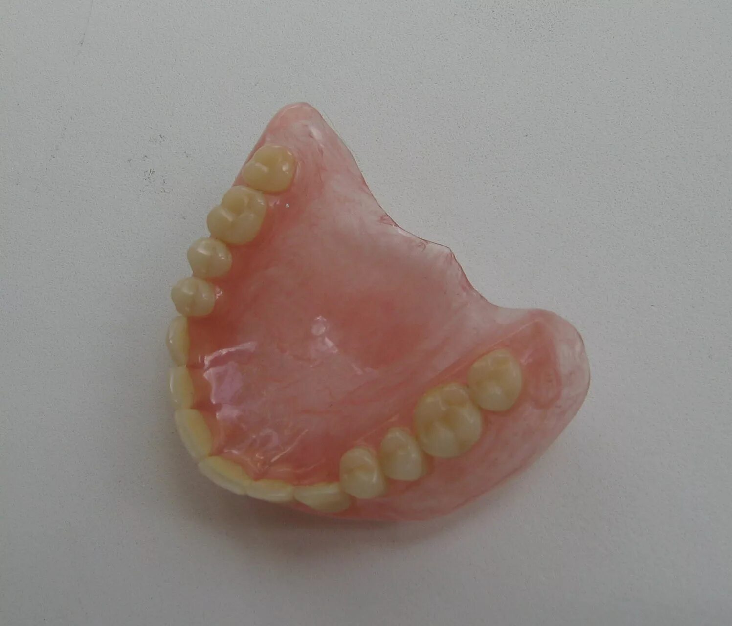 квадротти верхняя челюсть фото. бюгельный протез ацетал. протезы quattro ti квадротти. бюгельный протез квадротти. бюгельный протез квадротти.