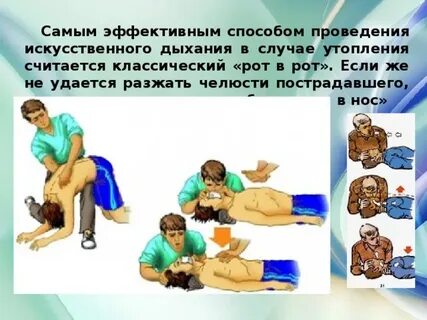 Эффективное искусственное дыхание