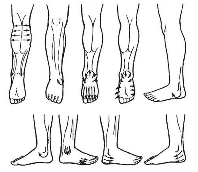 Лимфодренажный массаж конечности. Массаж ног при варикозе нижних конечностей лимфодренажный техника. Лимфодренажный массаж нижних конечностей схема. Массаж нижних конечностей техника. Направление движений при массаже нижних конечностей.