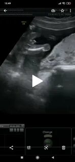 Когда по узи можно узнать пол ребенка