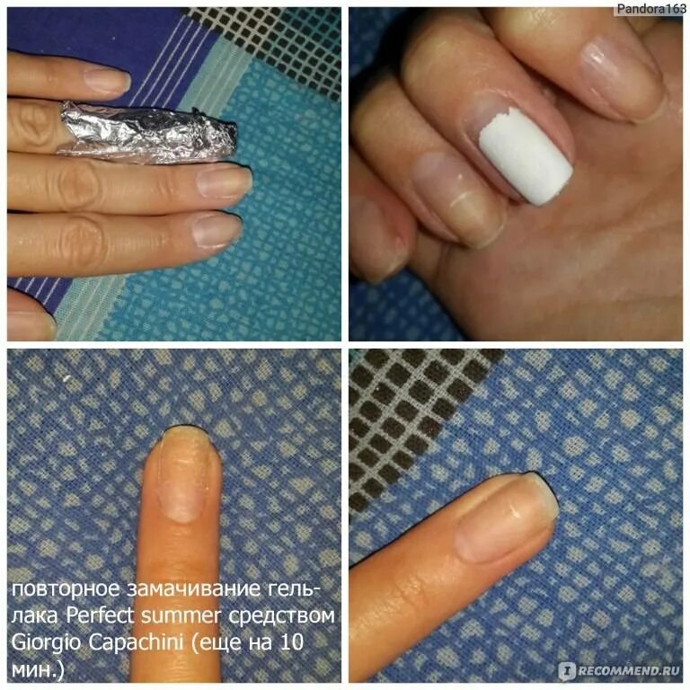 Содранное покрытие с ногтей. Снятие гель лака с ногтей. Чем покрыть ногти после геля