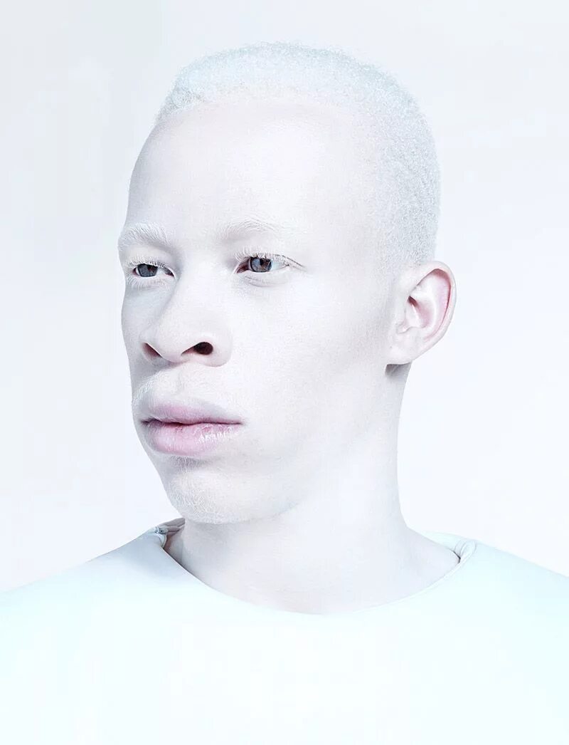 Человек с самой светлой. Альбинос негроидной расы. Джуэлл Джеффри альбинос. Негр альбинос модель. Негр Альбатрос.