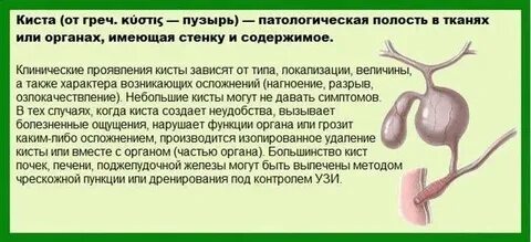 Лечение кисты под микроскопом