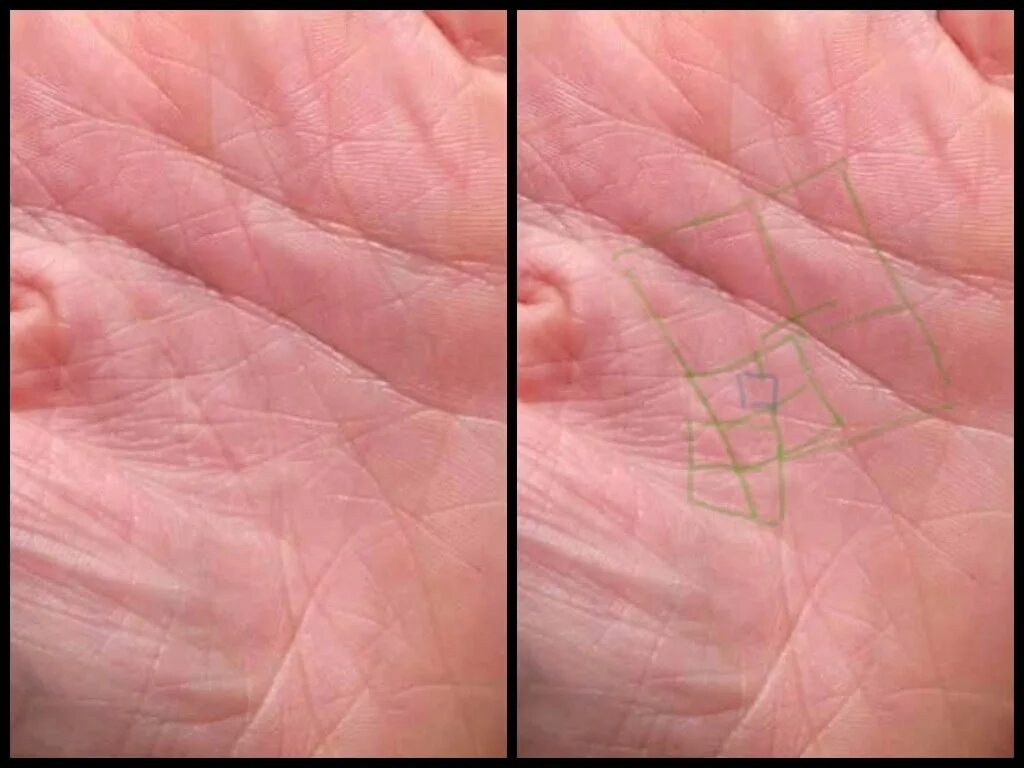 денежный знак на руке. линия жизни на ладони. линии на ладони. квадрат на линии судьбы. квадрат на ладони.