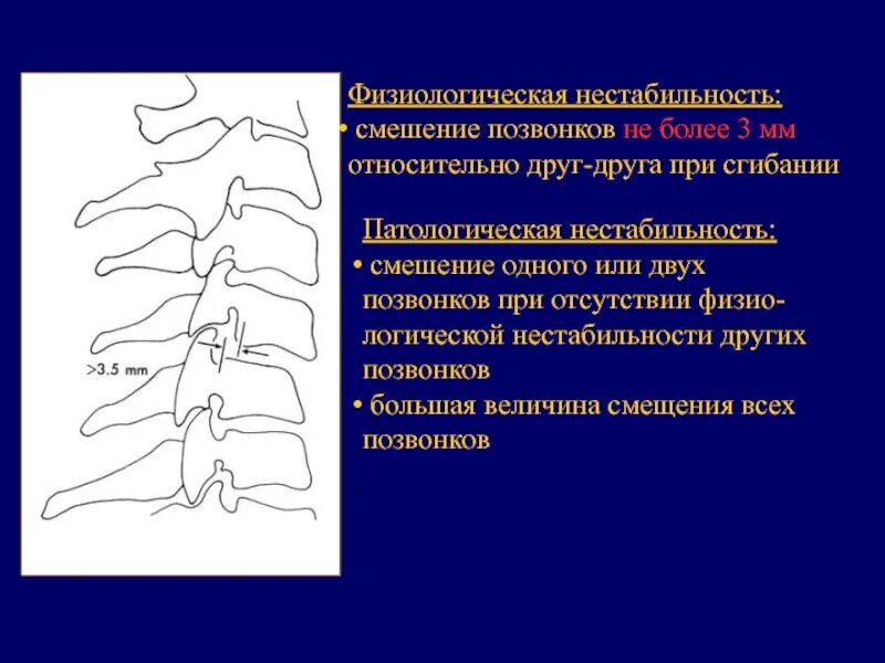 Спинальная нестабильность что это. Сегментарная нестабильность позвоночника. Нестабильность поясничного отдела позвоночника. Нестабильный поясничный позвонок. Неустойчивость шейных позвонков.