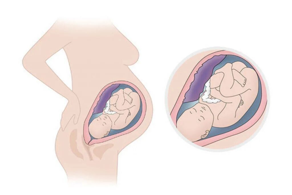 Расположение ребенка на 37 неделе беременности. Малыш на 37 неделе беременности в животе. Расположение малыша в животе на 37 неделе беременности. Расположение плода на 39 неделе беременности. Беременность 39 недель как ускорить