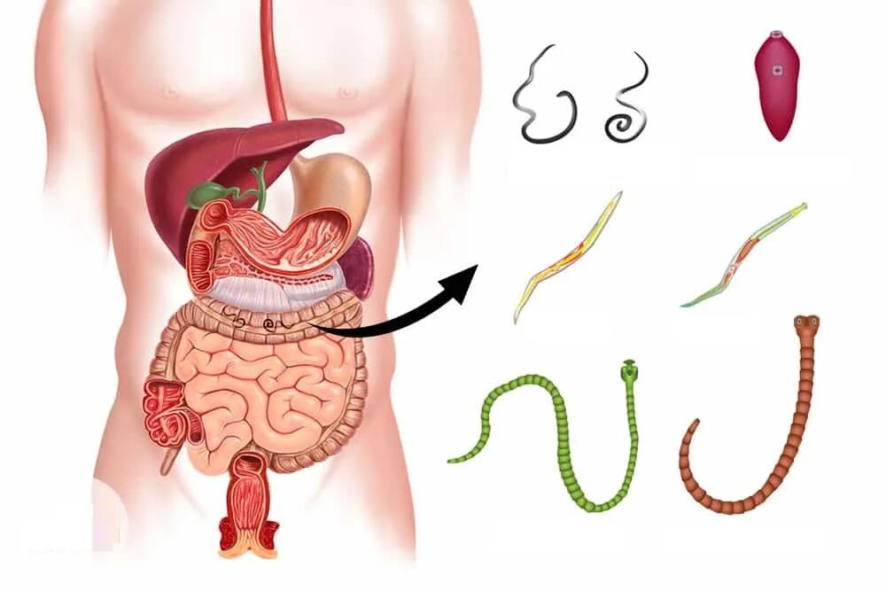 Откуда берутся черви. Червяки живущие в организме человека.