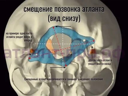 Атлант сустав шейный