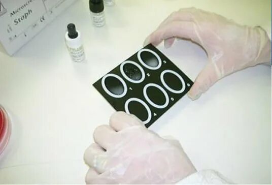 Метод латекс агглютинации. Срб-латекс-витал в 201. Реакция латекс агглютинации компоненты. Метод латекс агглютинации. Реакция латекс агглютинации.