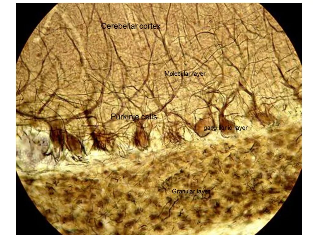 Ирритация коры головного мозга. Мозжечок гистология препарат. Мозжечок гистология препарат гематоксилин. Срез коры мозжечка препарат гистология.