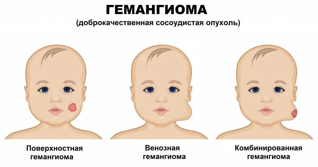 Типа у ребенка форум