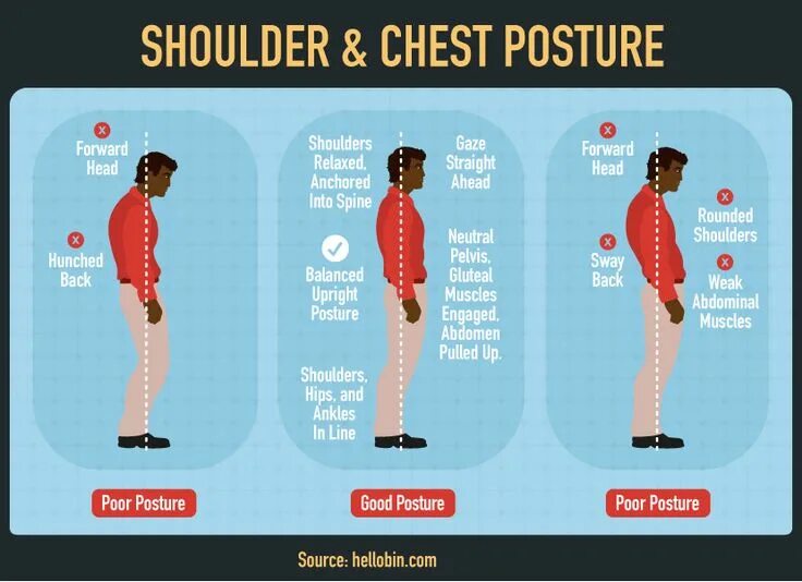 Posture испанская. Sway back осанка. Sway back posture. Upright posture. Straight back