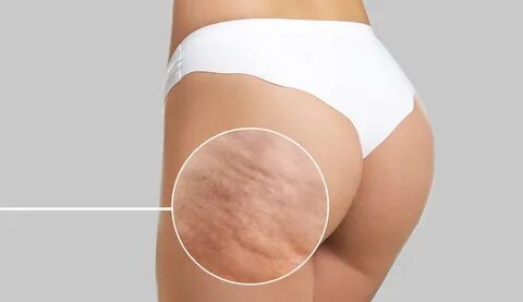 Kochadan uysiz ayol bilan jinsiy aloqa