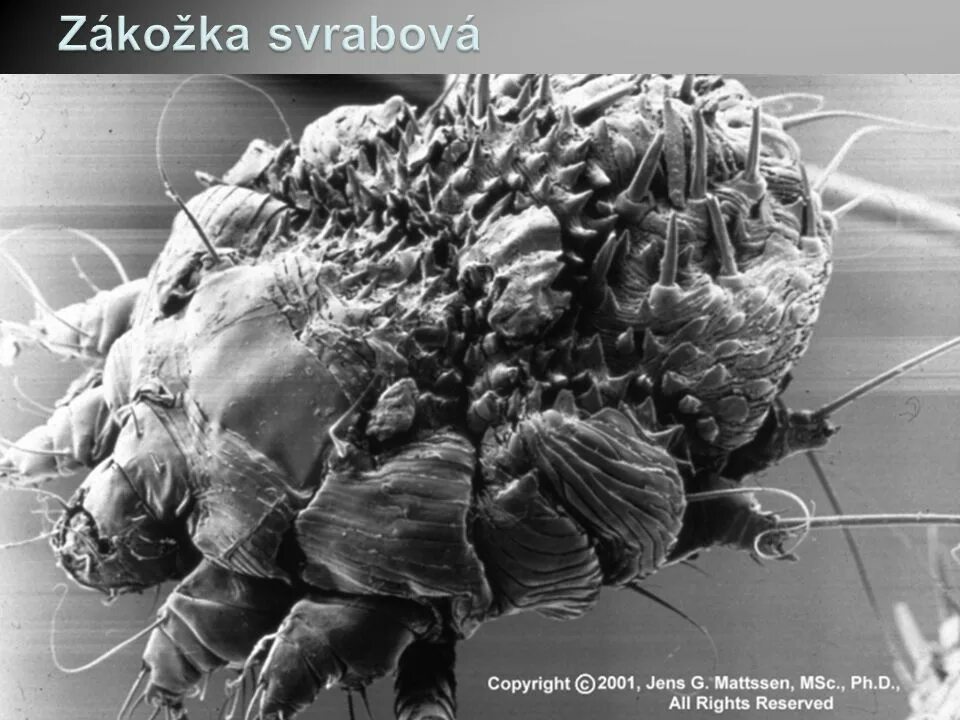 Клещи паразиты таблетки. Чесоточный зудень (Sarcoptes scabiei). Чесоточный клещ Sarcoptes scabiei Hominis. Чесоточный зудень паразит. Чесоточный клещ под микроскопом.