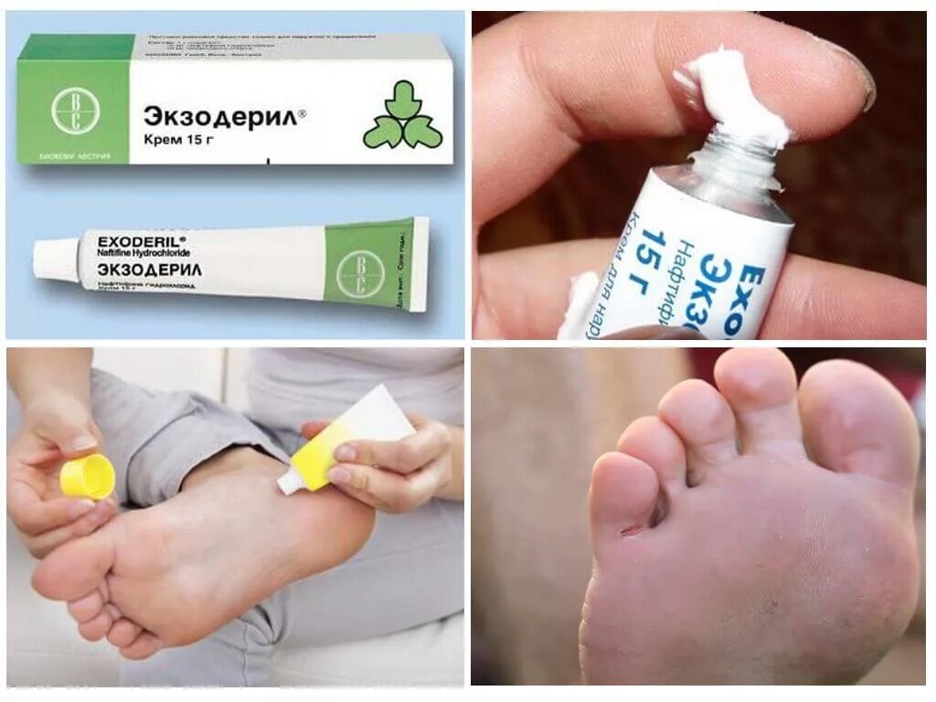 Чем помазать между пальцами. Мазь от грибка ногтей на ногах. Чем помазать между пальцами. Натертости на пальцах ног. Мазь от грибка.