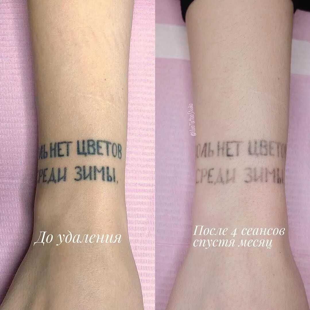 Татуировки через несколько лет. Тату через время. Цветные тату через 10 лет. Тату спустя год. Татуировка спустя 10 лет.