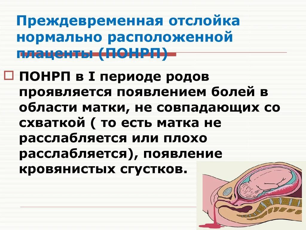 Отслойка нормально расположенной плаценты симптомы. Преждевременная отслойка плаценты. Преждевременная отслойка нормально расположенной. Преждевременная отслойка нормально расположенной плаценты родв. Периоды родов что происходит