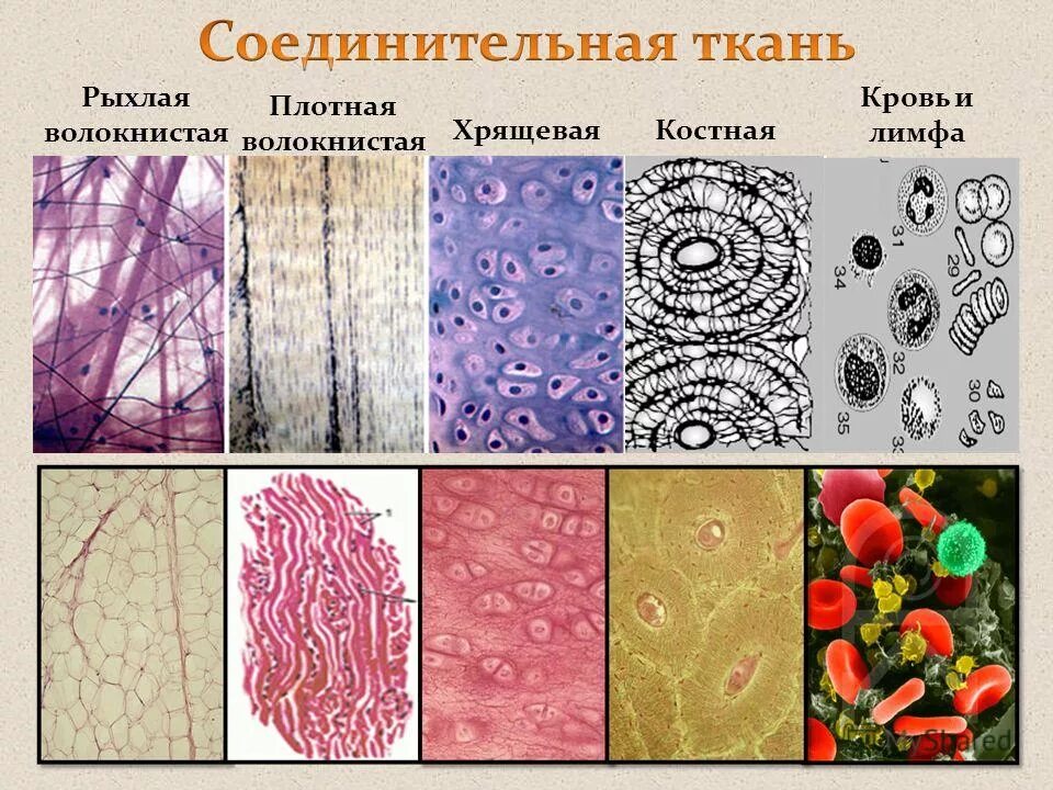 Ткани эпителиальная соединительная мышечная нервная рисунки. Соединительные ткани человека 8 класс биология. Виды соединительной ткани человека рисунок. Биология 8 класс ткани соединительной ткани. Основное группа ткани человека