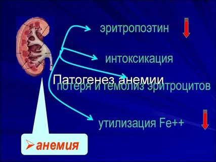 Почечная анемия лечение
