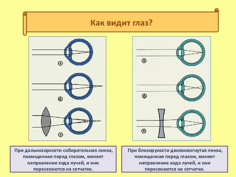 Зрение не вижу близко. Как видит глаз. Как видит глаз человека. Какак видит глаз человека. Как видит глаз человека схема.