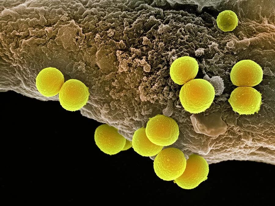 2 staphylococcus aureus. Стафилококк ауреус микроскоп. s. aureus золотистый стафилококк. стафилококк ауреус микробиология. стафилококк ауреус под микроскопом.