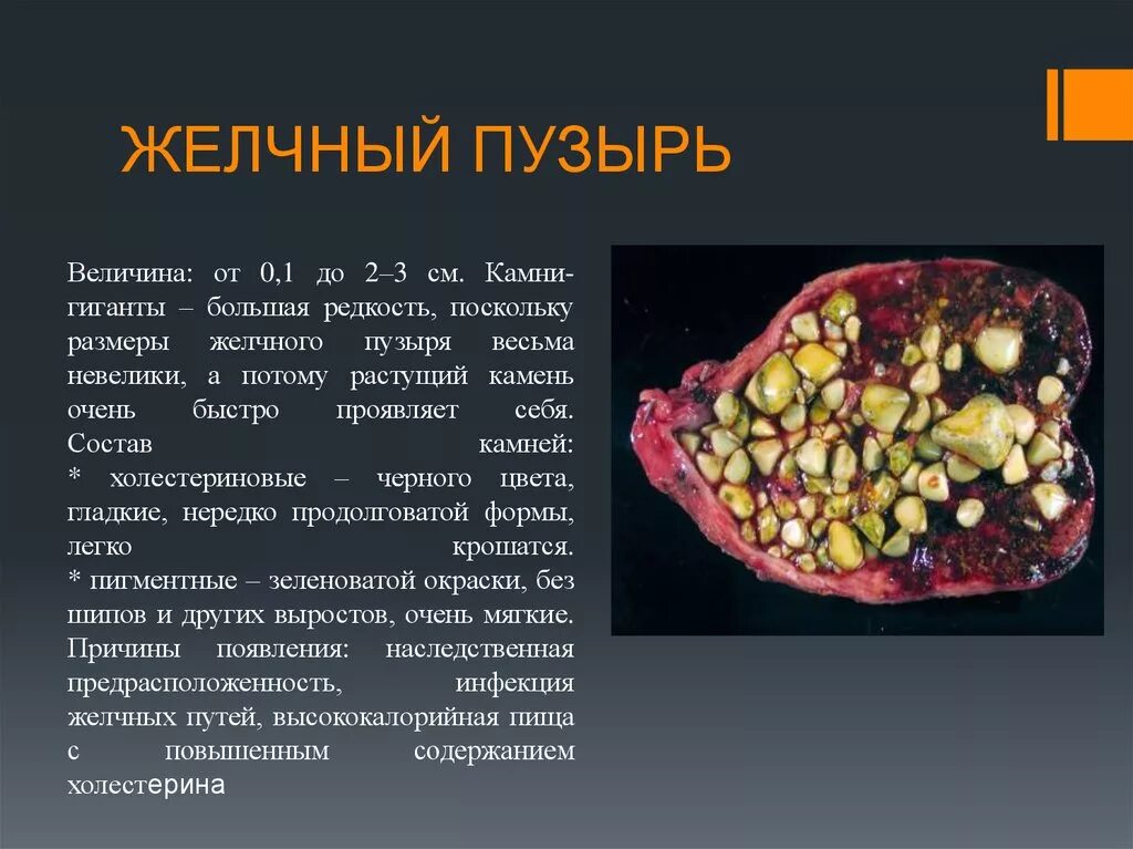 Размеры желчного пузыря. Диаметр желчного пузыря. Какого размера желчный пузырь. Площадь желчного пузыря.