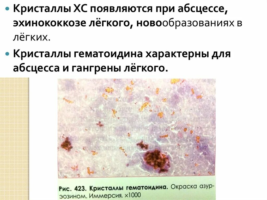 Ржавая мокрота заболевание