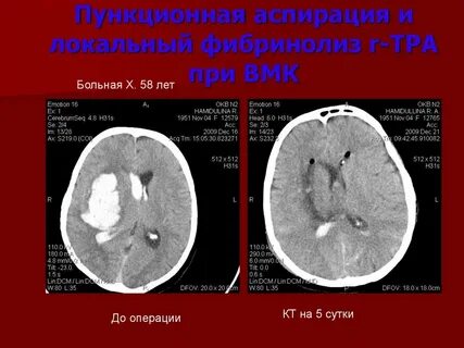 Операция кт