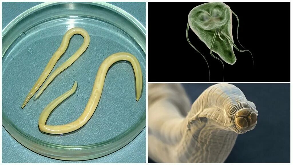 какие паразиты водятся