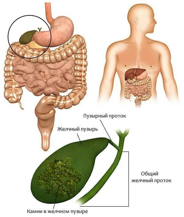 Увеличился желчный пузырь. Анатомия человека внутренние органы желчный пузырь. Увеличенная печень и желчный пузырь.