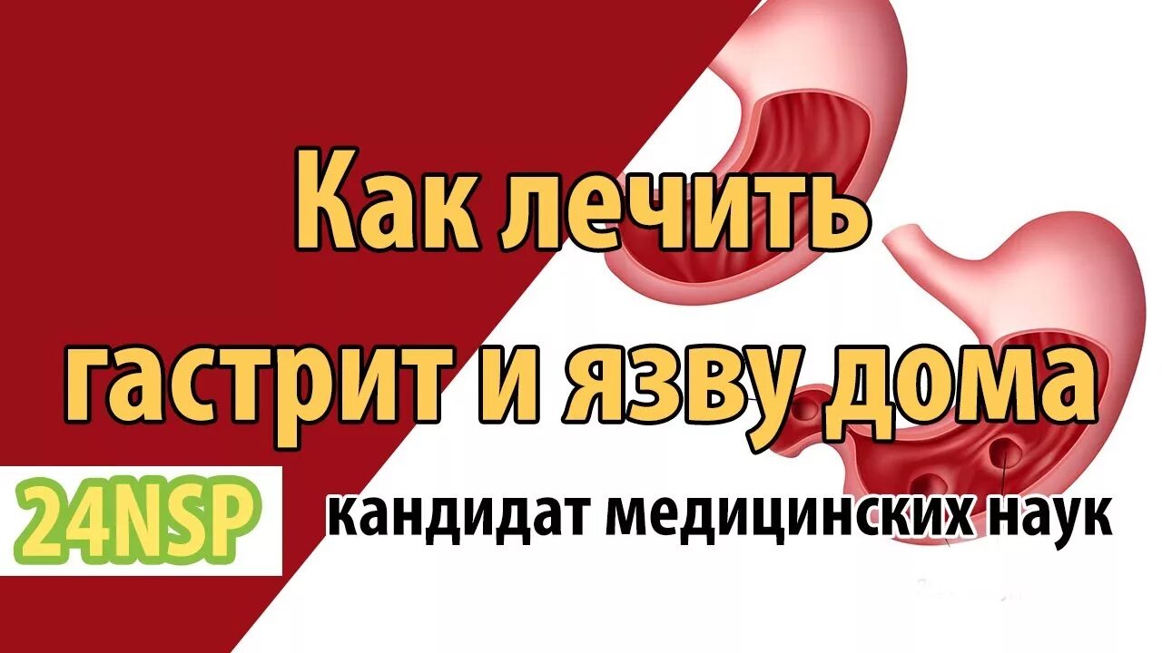 Как лечить гастрит и язву желудка дома Как делать профилактику гастрита и язвы