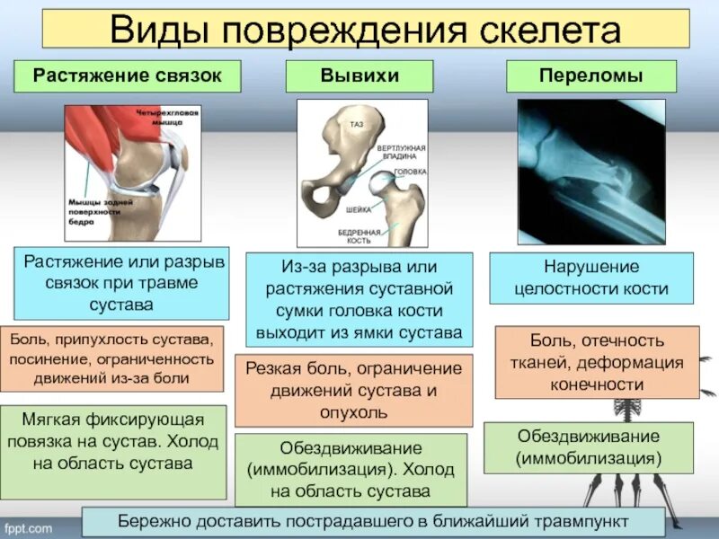 Основной признак травмы. Вывихи и растяжения презентация. Перелом вывих растяжение. Переломы и вывихи презентация. Переломы и растяжения для презентации.