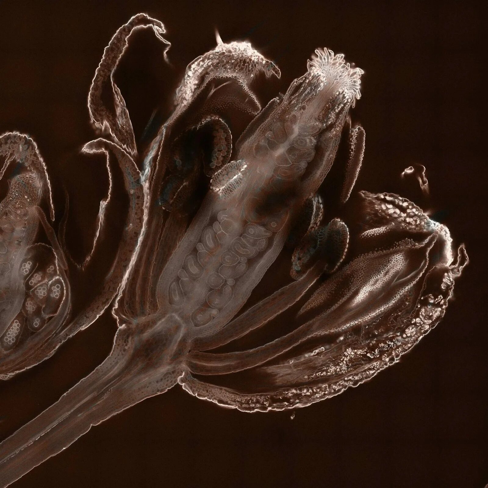 Поперечный срез завязи пестика лилии под микроскопом. Arabidopsis thaliana под микроскопом. Семяпочка под микроскопом. Завязь и семяпочка под микроскопом. Завязь и семяпочка под микроскопом цветка.