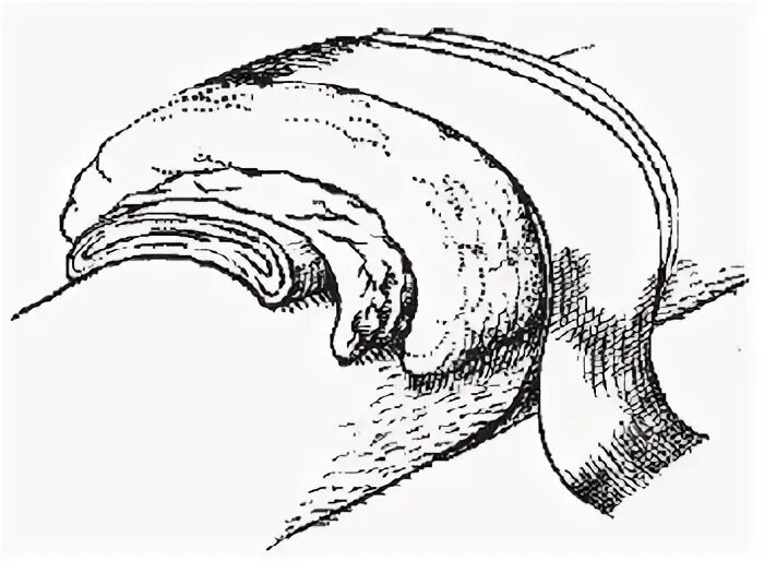Техника наложения компресса. Согревающий компресс слои. Сухой согревающий компресс. Наложение согревающего компресса. Места постановки согревающего компресса.